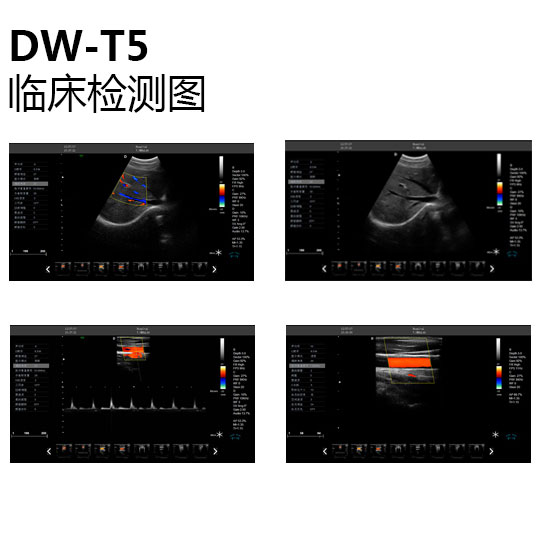 彩超機(jī)臨床檢測(cè)圖